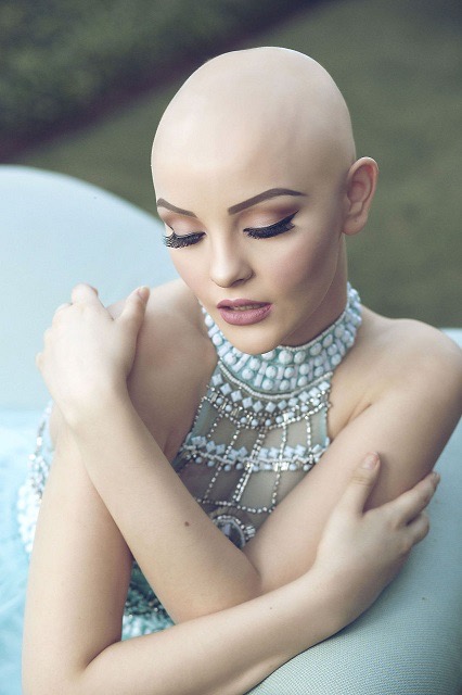 ガンは、私の美を奪えない。治療で髪を失った17歳の少女